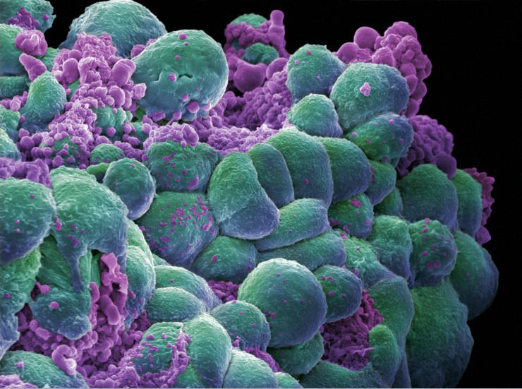 Биоразлагаемые наночастицы помогут в борьбе с раком