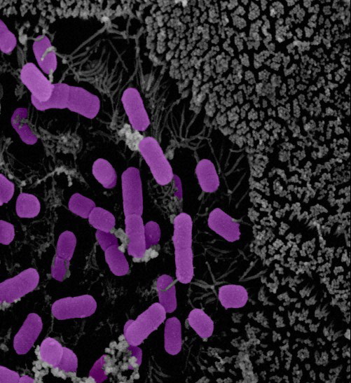 Человеческие бактерии изменили поведение мышей