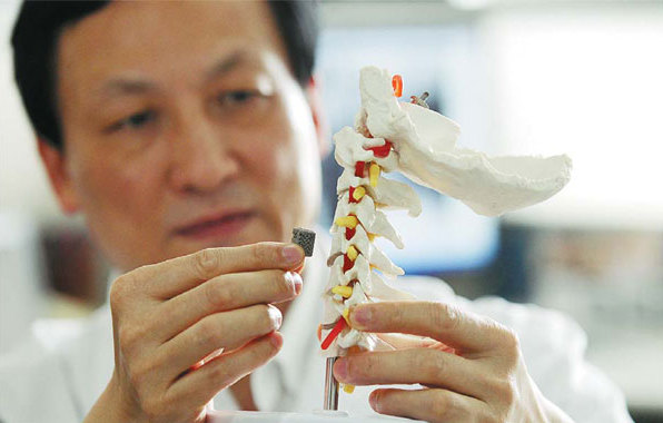 Китайским пациентам имплантировали первые в мире 3d-печатные позвонки