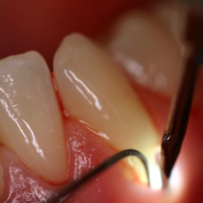 Клеточные технологии в помощь стоматологам