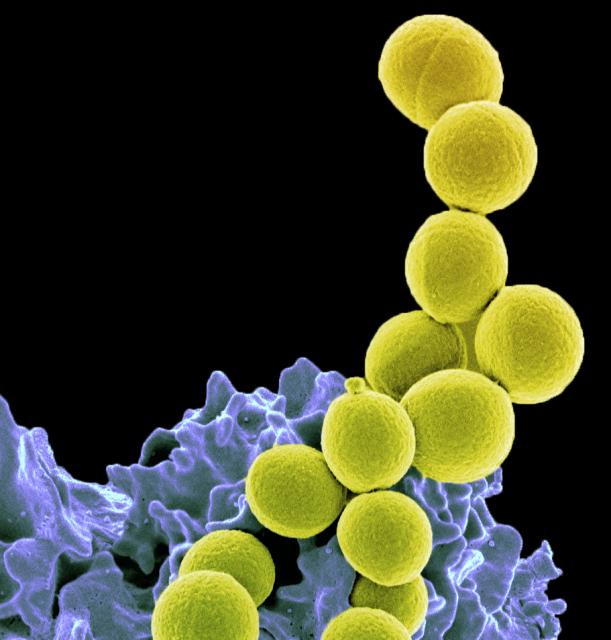 Лекарственную устойчивость бактерий нанесли на карту