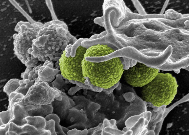 Микробы гибнут за металл