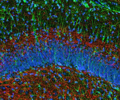 Мозг чистит память с помощью новых нервных клеток