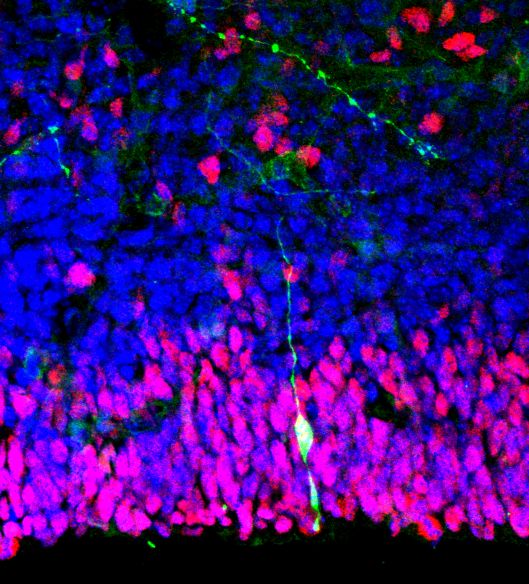 Мозг людей стал большим из-за «продвинутых» стволовых клеток