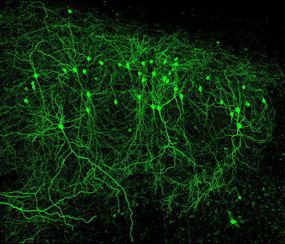 Мозг сам управляет производством новых нейронов