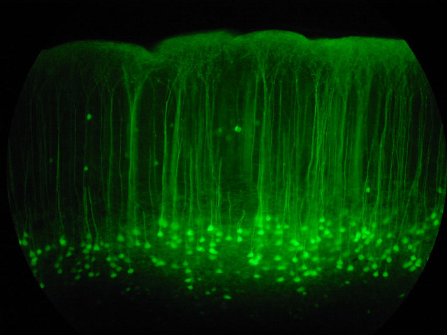 Почему нейроны не похожи друг на друга