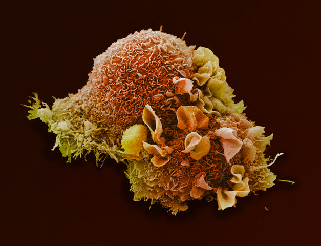 Сколько мутаций в раковой опухоли
