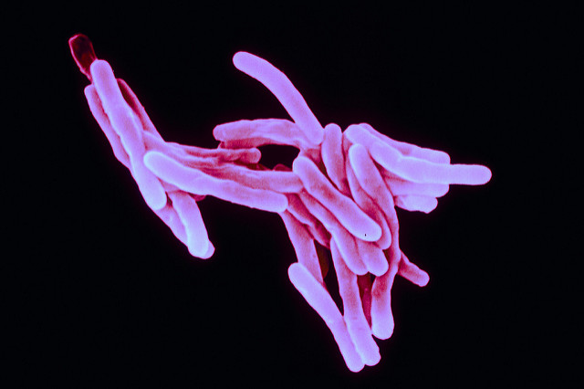 У лекарственно-устойчивого туберкулеза нашли слабое место