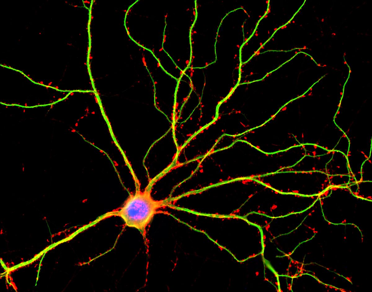 У нервных клеток нашли неучтенную активность