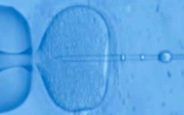 Ученые превратили клетки кожи в сперматозоиды