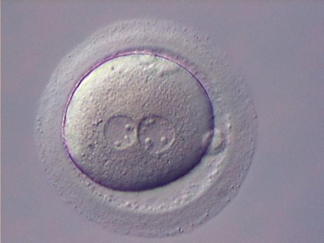 В оплодотворенной яйцеклетке рассмотрели структуру днк