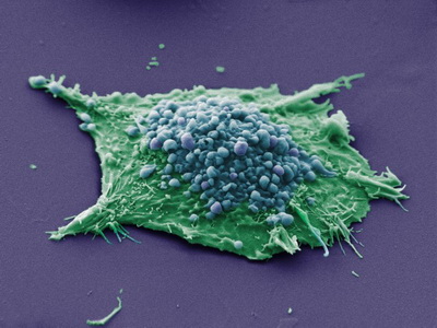 Вероятность рака зависит от активности стволовых клеток