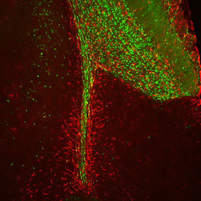 Зачем мозгу новые нейроны